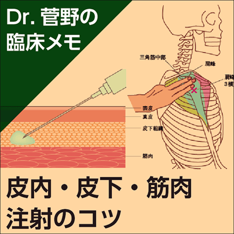 皮内・皮下・筋肉注射のコツ〜Dr.菅野の臨床メモ
