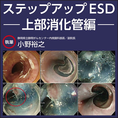 ステップアップESD〜上部消化管編