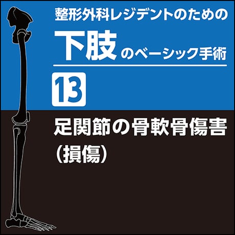 整形外科レジデントのための下肢のベーシック手術13　足関節の骨軟骨傷害（損傷）（PDF版）