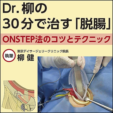 Dr.柳の30分で治す「脱腸」〜ONSTEP法のコツとテクニック