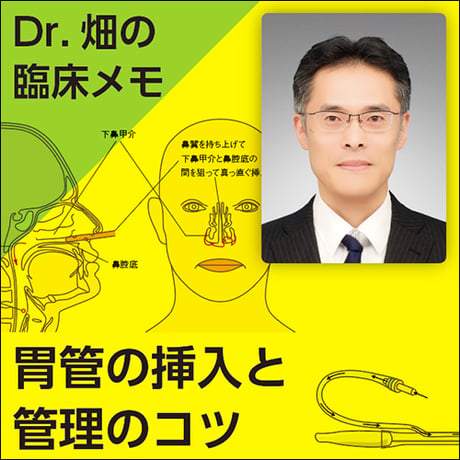 胃管の挿入と管理のコツ〜Dr.畑の臨床メモ