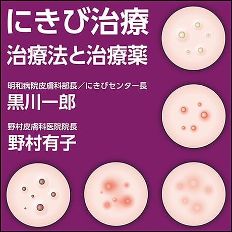にきび治療〜治療法と治療薬