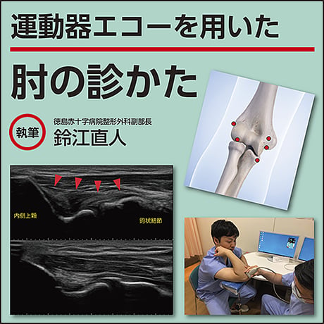 運動器エコーを用いた 肘の診かた