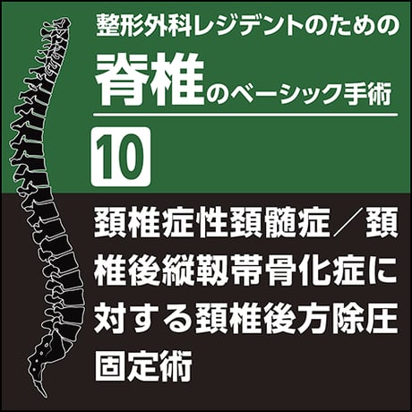 整形外科レジデントのための脊椎のベーシック手術10　頚椎症性頚髄症／頚椎後縦靱帯骨化症に対する頚椎後方除圧固定術（PDF版）