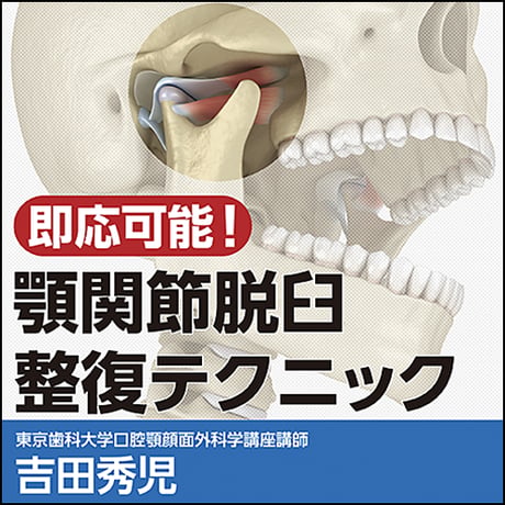 即応可能！顎関節脱臼整復テクニック