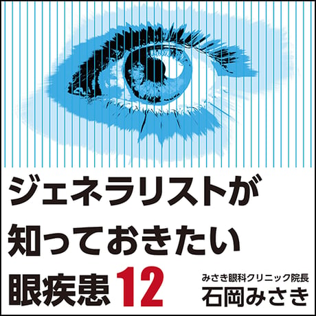 ジェネラリストが知っておきたい眼疾患12