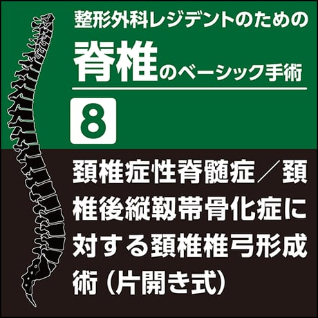 整形外科レジデントのための脊椎のベーシック手術8　頚椎症性脊髄症／頚椎後縦靱帯骨化症に対する頚椎椎弓形成術（片開き式）（PDF版）