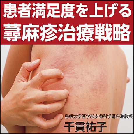 患者満足度を上げる蕁麻疹治療戦略