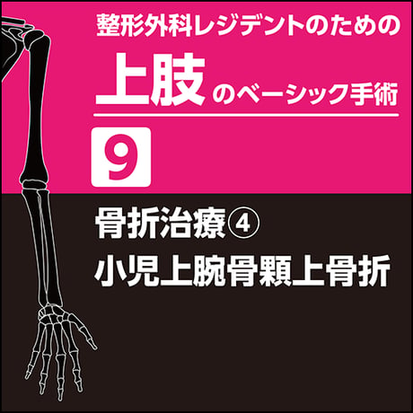 整形外科レジデントのための上肢のベーシック手術9 骨折治療4 小児上