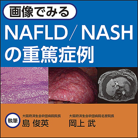 画像でみる NAFLD／NASHの重篤症例