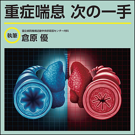 重症喘息 次の一手