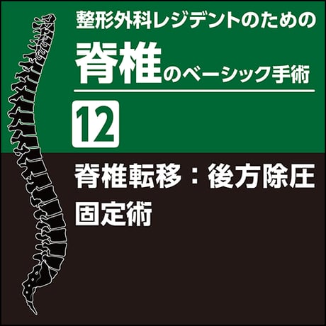 整形外科レジデントのための脊椎のベーシック手術12　脊椎転移：後方除圧固定術（PDF版）