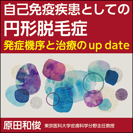 自己免疫疾患としての円形脱毛症〜発症機序と治療のup date