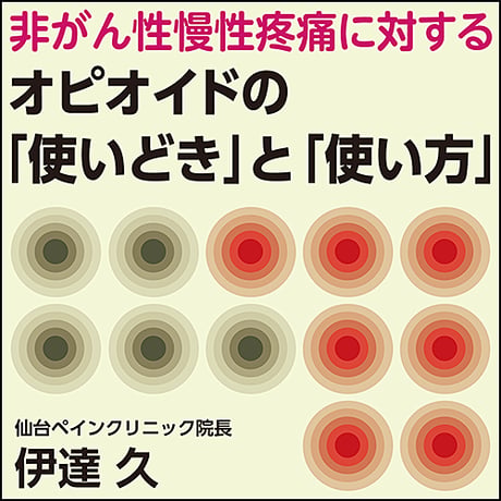 非がん性慢性疼痛に対するオピオイドの「使いどき」と「使い方」