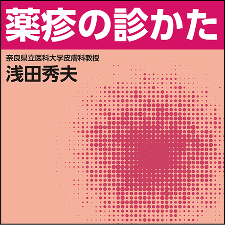 薬疹の診かた