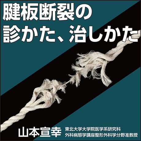 腱板断裂の診かた、治しかた