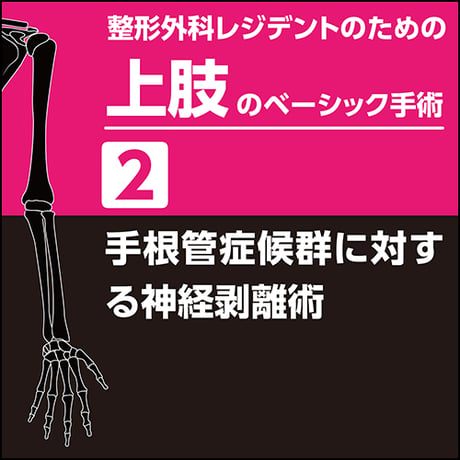 整形外科レジデントのための上肢のベーシック手術2　手根管症候群に対する神経剥離術（PDF版）