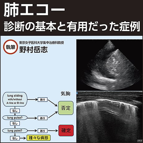 肺エコー〜診断の基本と有用だった症例