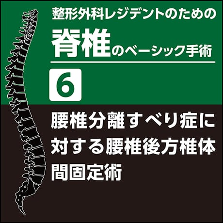 腰椎の手術 : ベーシックからアドバンストまで必須テクニック 腰椎の手術 ベーシックからアドバンストまで必須テクニック OS NOW