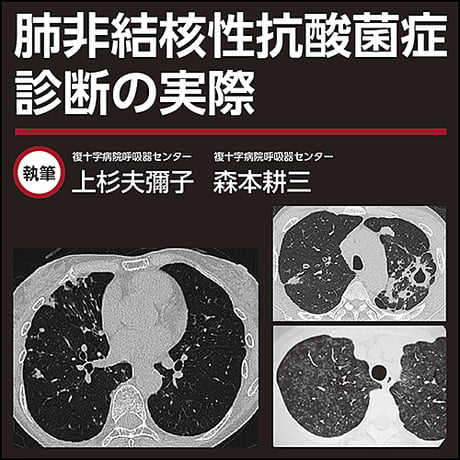 肺非結核性抗酸菌症〜診断の実際