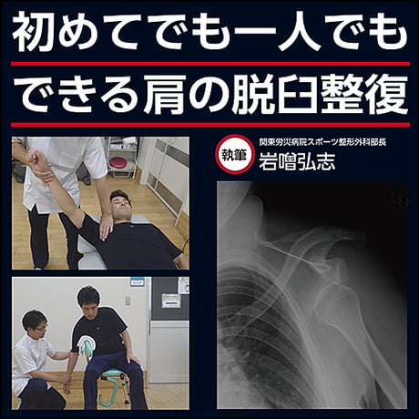 初めてでも一人でもできる肩の脱臼整復
