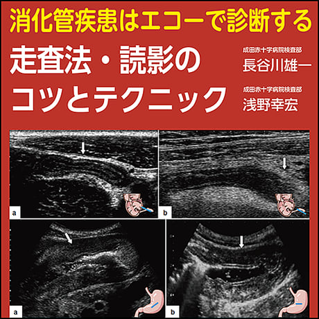 消化管疾患はエコーで診断する〜走査法・読影のコツとテクニック