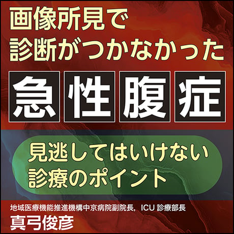 画像所見で診断がつかなかった急性腹症〈見逃してはいけない診療のポイント〉
