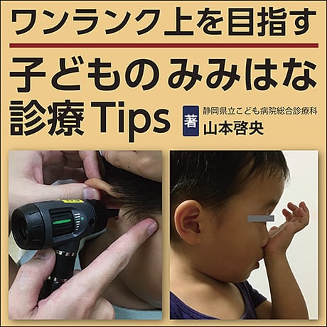 ワンランク上を目指す 子どものみみはな診療Tips