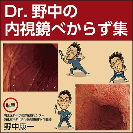 Dr. 野中の内視鏡べからず集〜とある内視鏡医が H. pylori 菌と胃内視鏡検診について考える