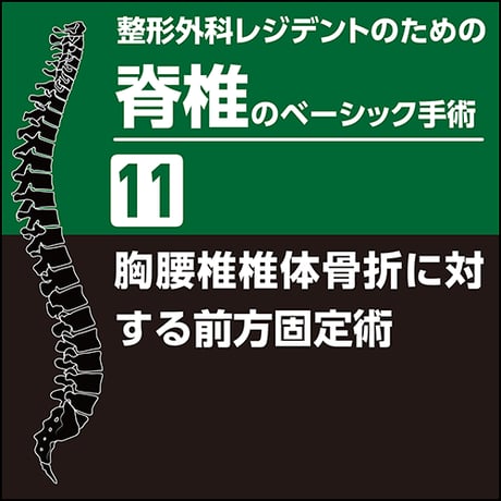 整形外科レジデントのための脊椎のベーシック手術11　胸腰椎椎体骨折に対する前方固定術（PDF版）