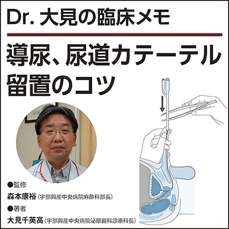 導尿、尿道カテーテル留置のコツ〜Dr.大見の臨床メモ