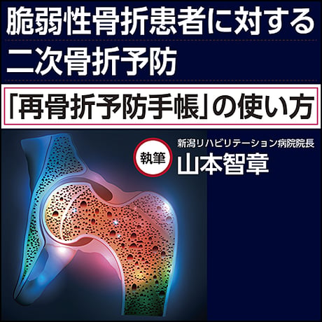 脆弱性骨折患者に対する二次骨折予防〜「再骨折予防手帳」の使い方