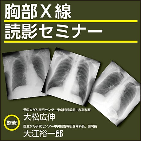 胸部X線読影セミナー