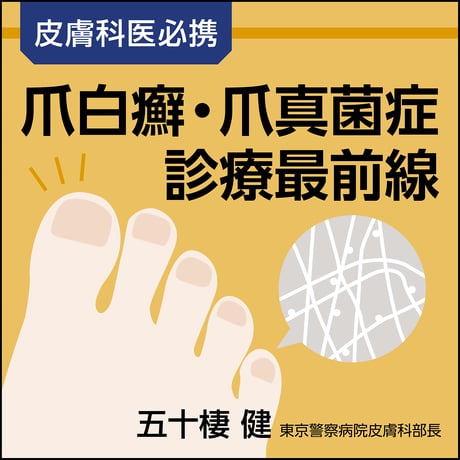 皮膚科医必携 爪白癬・爪真菌症診療最前線