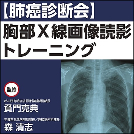 【肺癌診断会】胸部X線画像読影トレーニング