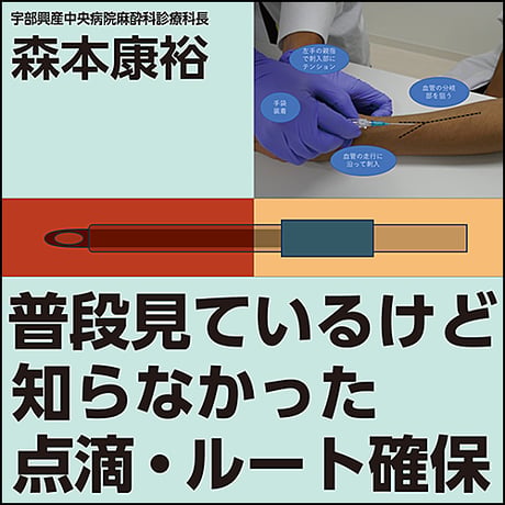 普段見ているけど知らなかった点滴・ルート確保