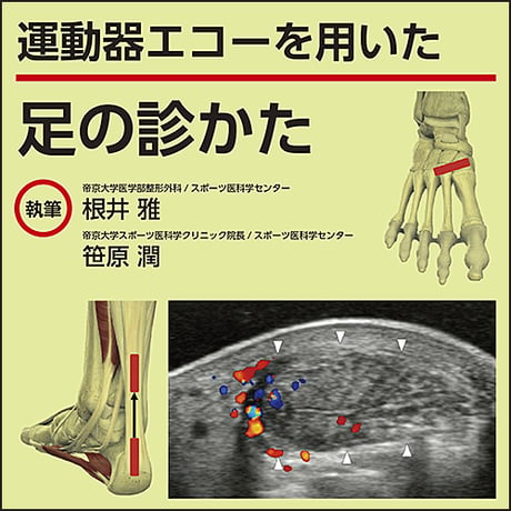 運動器エコーを用いた 足の診かた