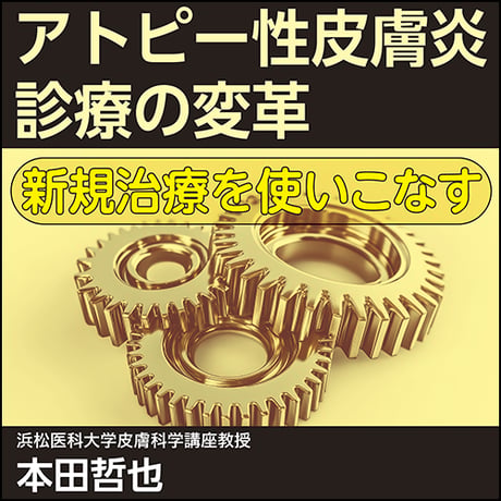 アトピー性皮膚炎診療の変革〈新規治療を使いこなす〉