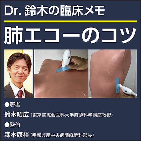 肺エコーのコツ〜Dr.鈴木の臨床メモ