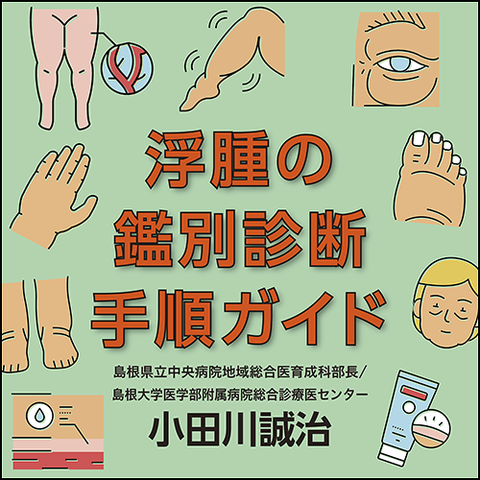 浮腫の鑑別診断手順ガイド