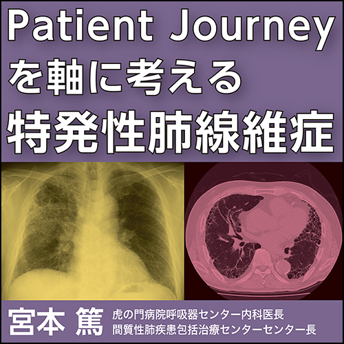 Patient Journeyを軸に考える特発性肺線維症