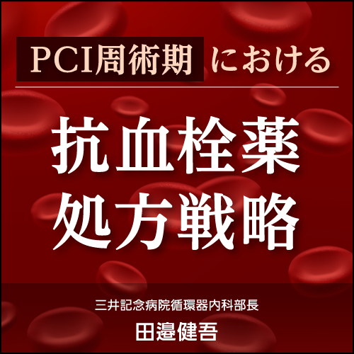 PCI周術期における抗血栓薬処方戦略