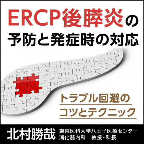ERCP後膵炎の予防と発症時の対応〈トラブル回避のコツとテクニック〉