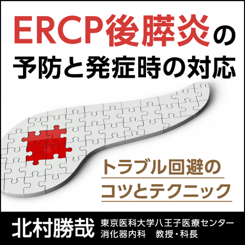 ERCP後膵炎の予防と発症時の対応〈トラブル回避のコツとテクニック〉
