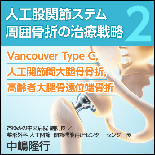 人工股関節ステム周囲骨折の治療戦略②〈Vancouver Type C，人工関節間大腿骨骨折，高齢者大腿骨遠位端骨折〉