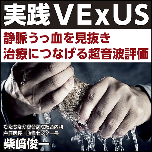 実践VExUS〈静脈うっ血を見抜き治療につなげる超音波評価〉