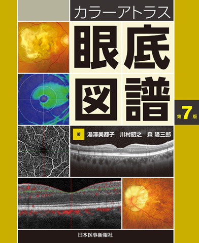 カラーアトラス眼底図譜｜書籍・jmedmook|日本医事新報社