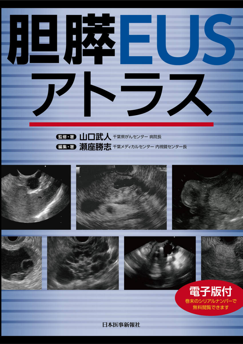 胆膵EUSアトラス【電子版付】｜書籍・jmedmook|日本医事新報社