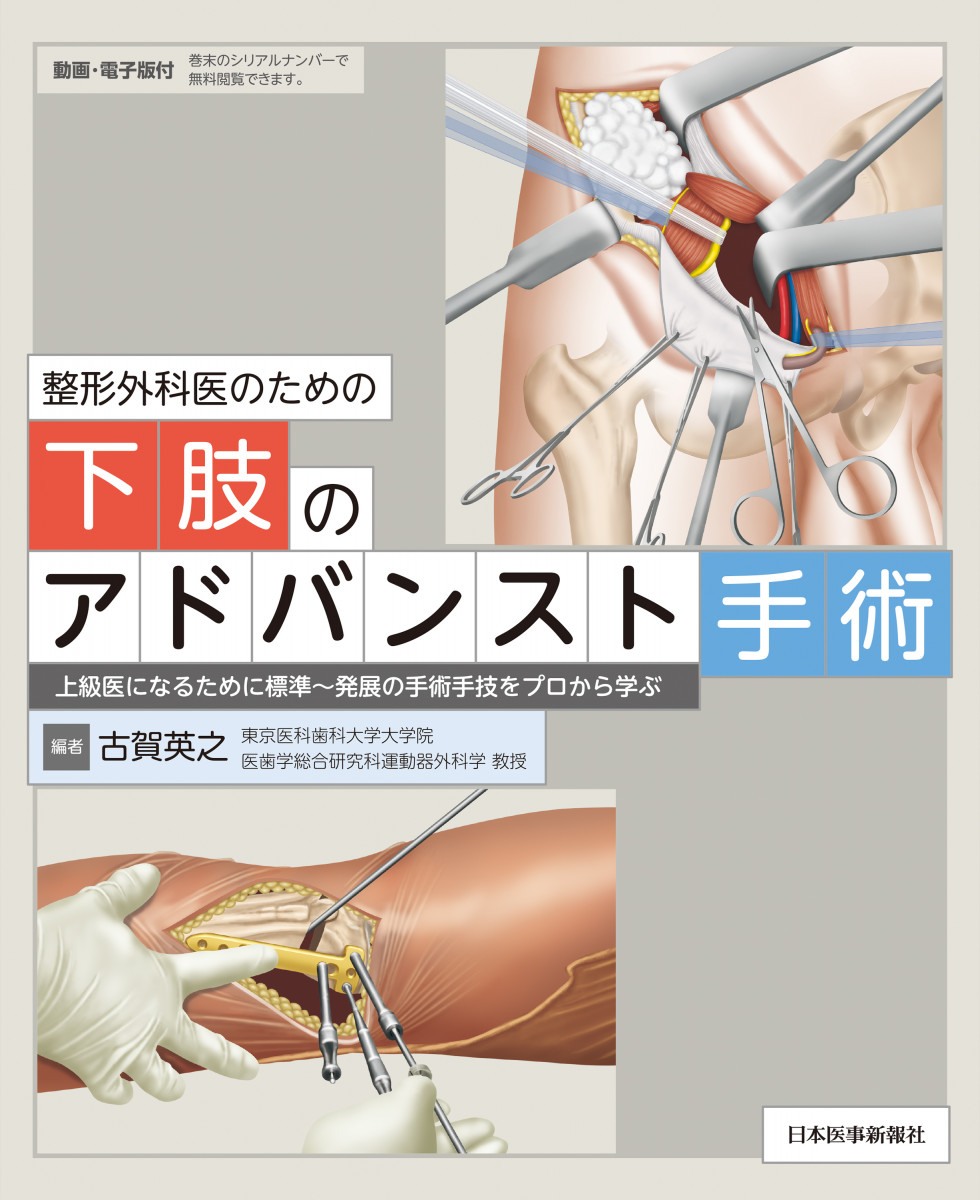 天ブックス: 整形外科レジデントのためのベーシック手術 上肢・脊椎 天ブックス: 整形外科レジデントのためのベーシック手術 上肢・脊椎