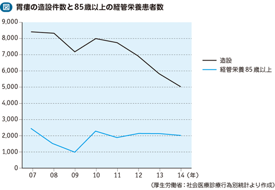 02_26_経管栄養（在宅医療）